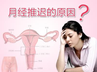 月经迟迟不来的原因(图2)